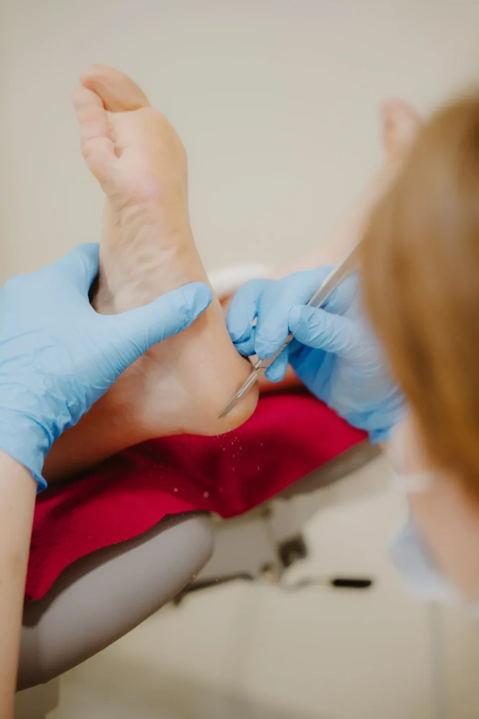 Gloved hands using a scalpel to remove hard skin from a heel during a chiropody treatment